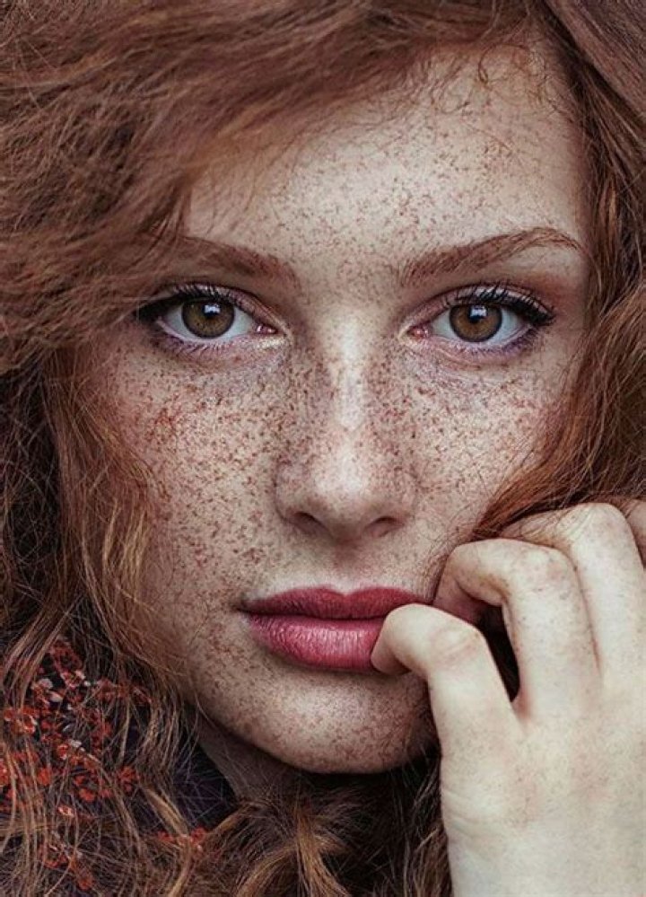 Are Freckles Attractive