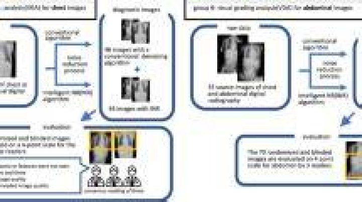 Artificial Intelligence Noise Reduction Artificial Intelligence Noise Reduction