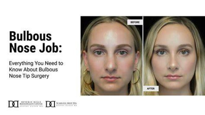 bulbous nose bulbous nose