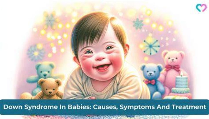 Down Syndrome in Babies Types, Causes & Treatment
