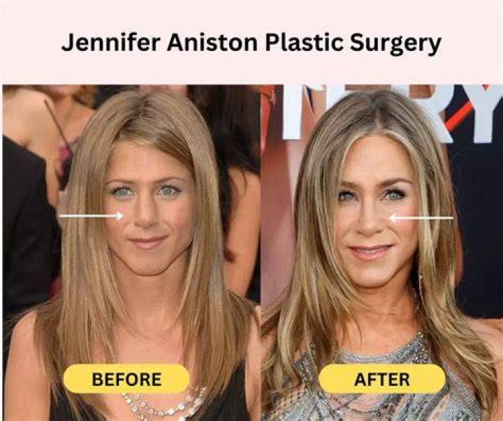How much plastic surgery has Putin had done?