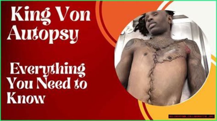 King Von Autopsy Report: A Comprehensive Analysis