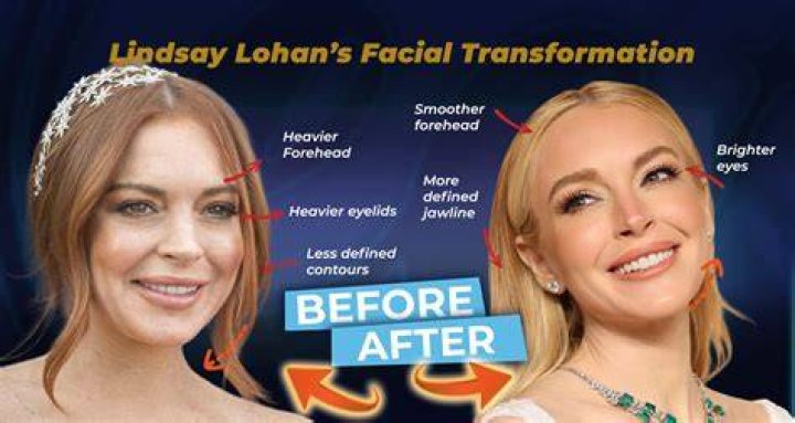 Lindsay Lohan Chops off Her Finger in a Boating Accident