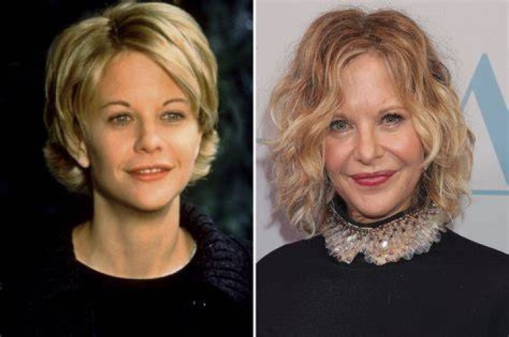 Meg Ryan revises her face again