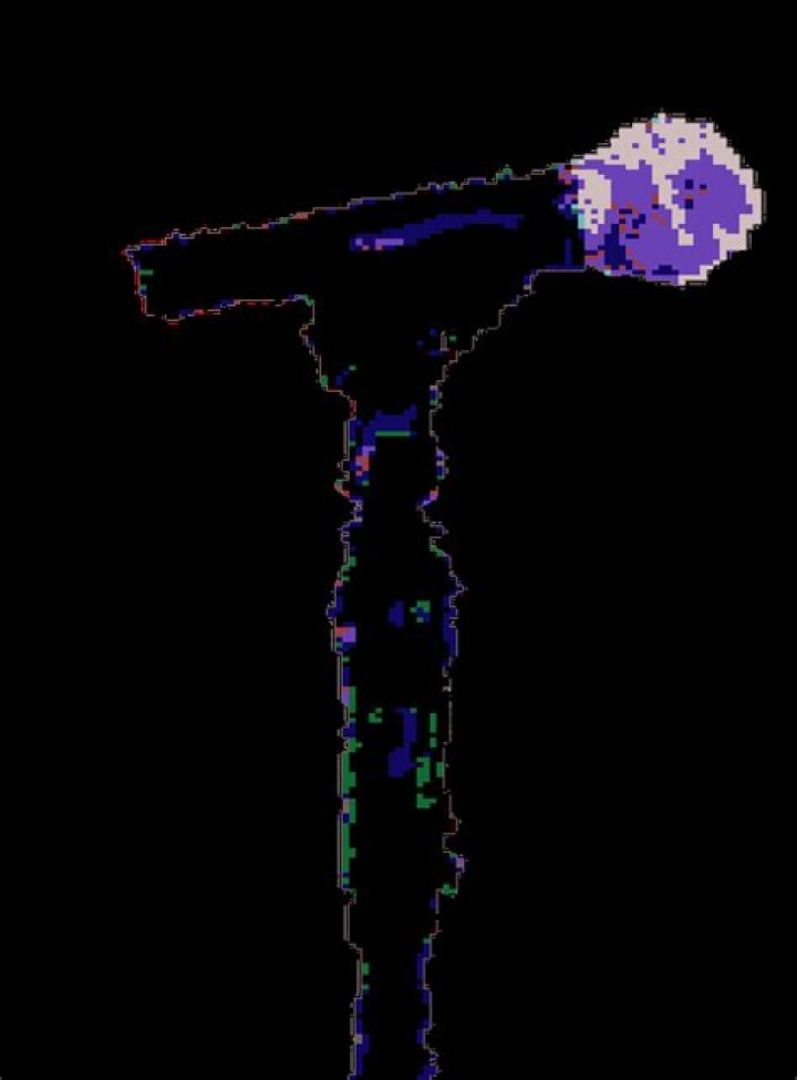 microphone entity