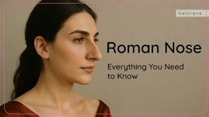 Roman noses Roman noses