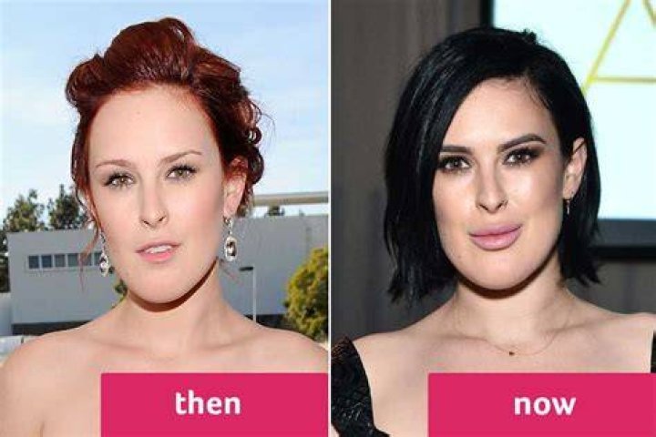Surgery Haley Giraldo