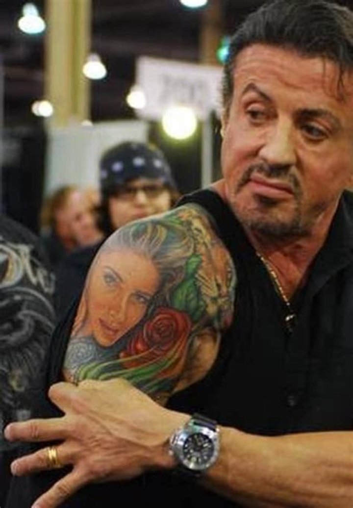 Sylvester Stallone getting his tattoo removed.