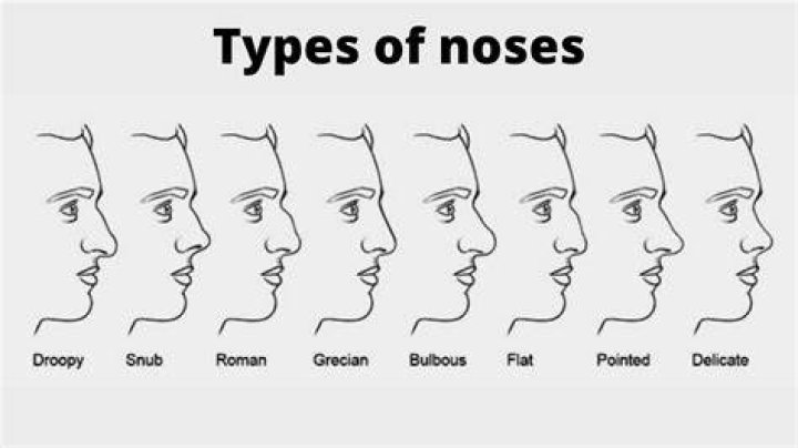 types of noses types of noses