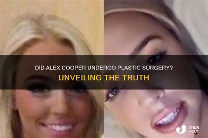 Unveiling The Truth Is Alex Roe Married?
