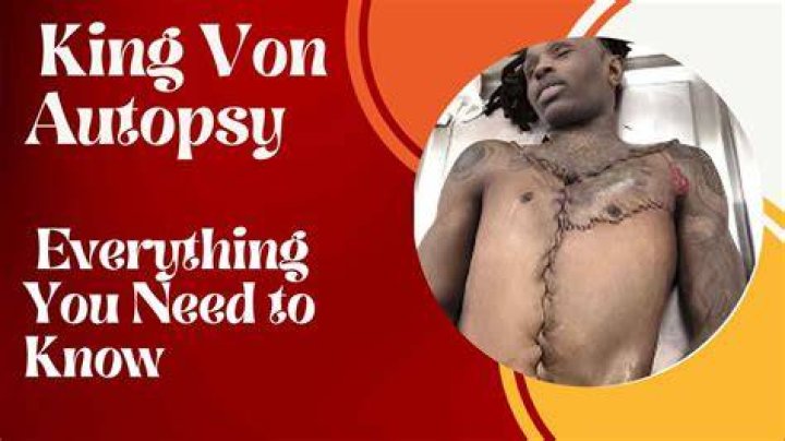 What does King von Autopsy say? Let's discover the real cause of his Death and Analysis of