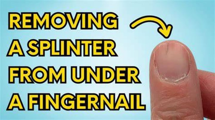 What Happens When U Swallow A Fingernail