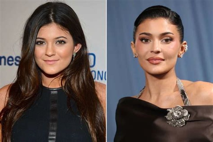 Why Kylie Jenner Admitted To Getting Breast Augmentation At 19 After Denying Ever Getting Plastic Surgery 